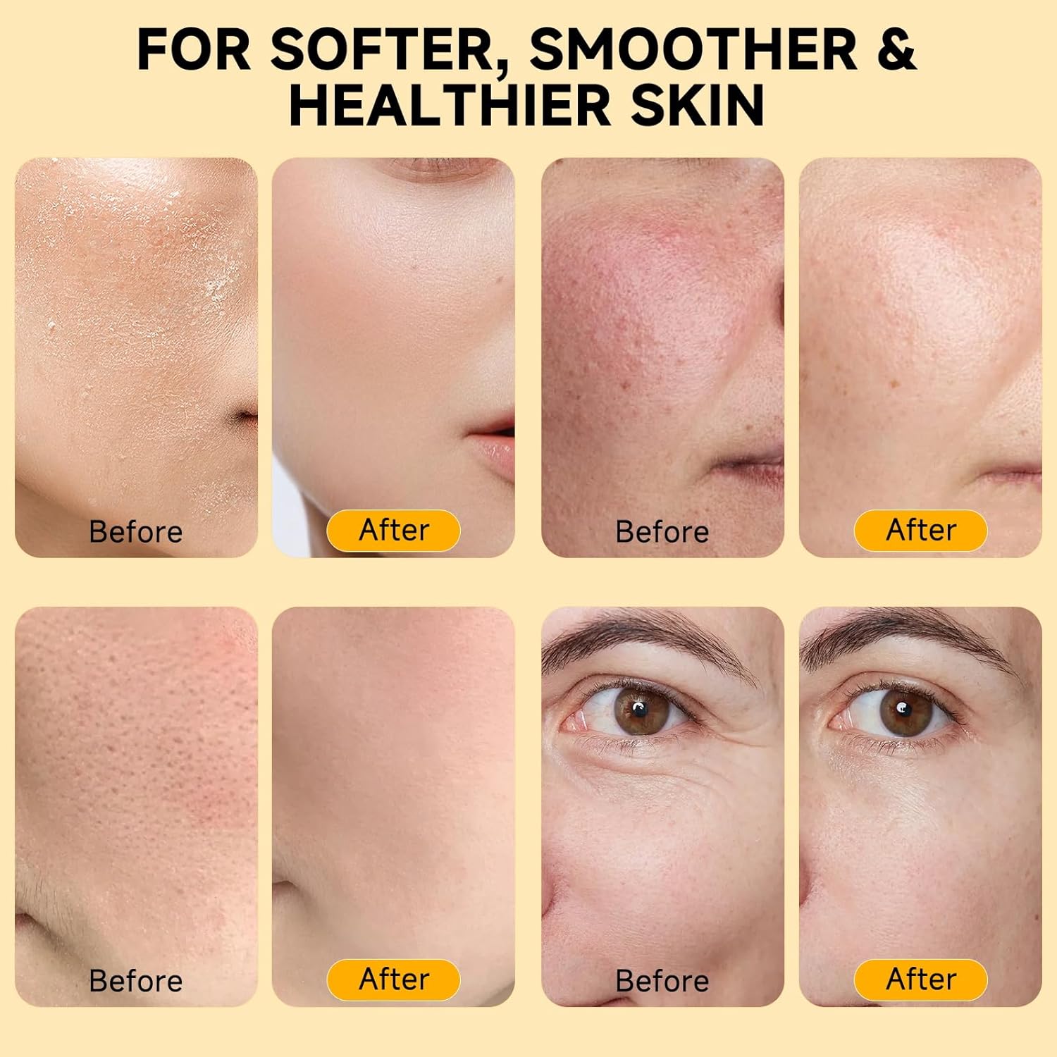 Organic Beef Tallow Honey Balm for Skin & Face, Whipped Beef Tallow Face Moisturizer with Raw Honey, Grass Fed Cow Beef Tallow Cream, All Natural Pure Body Lotion for Women & Men, Unscented 4.2 OZ - Image 3